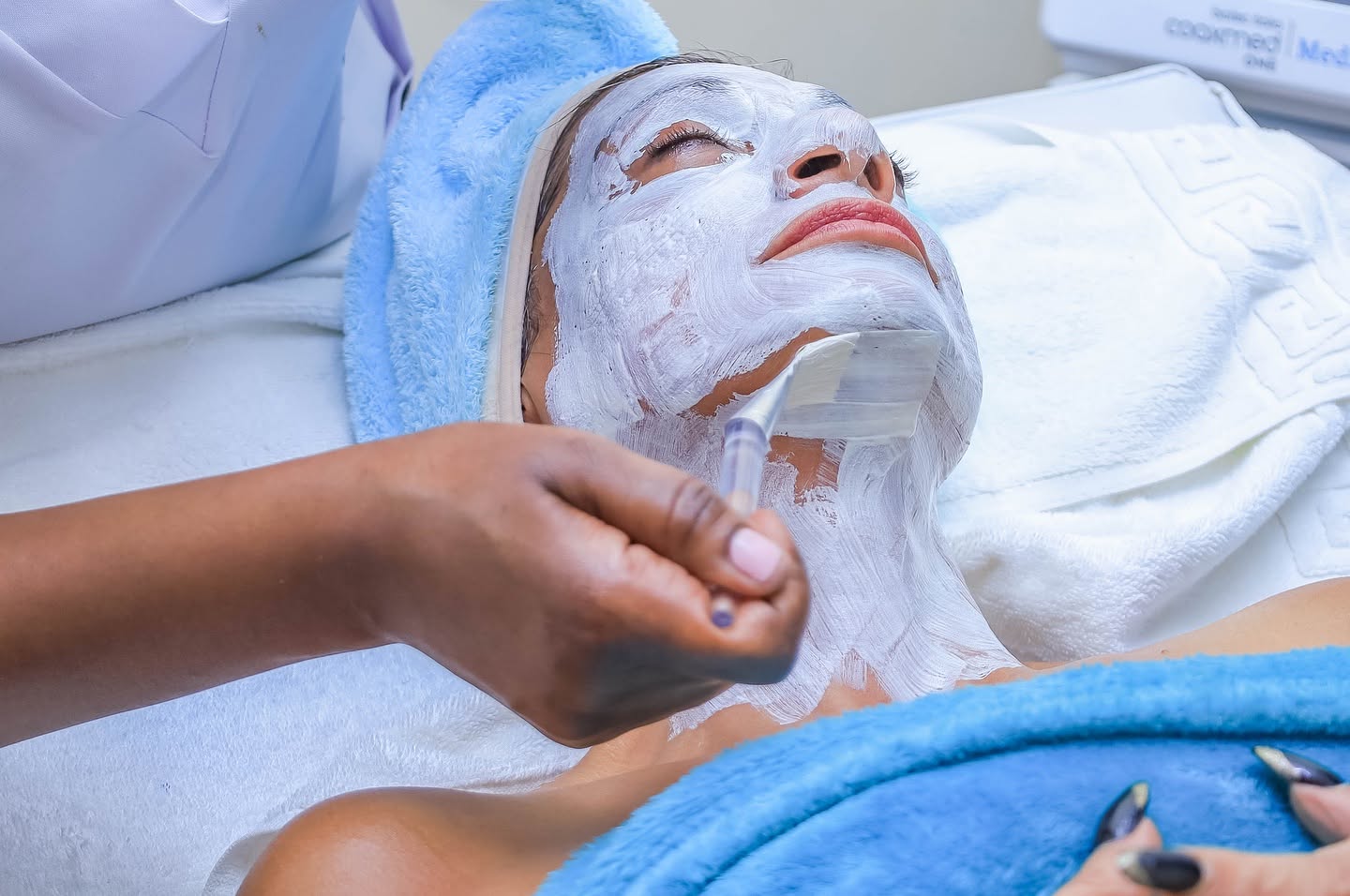 Chemical Peel in Riverside Drive: A Complete Guide